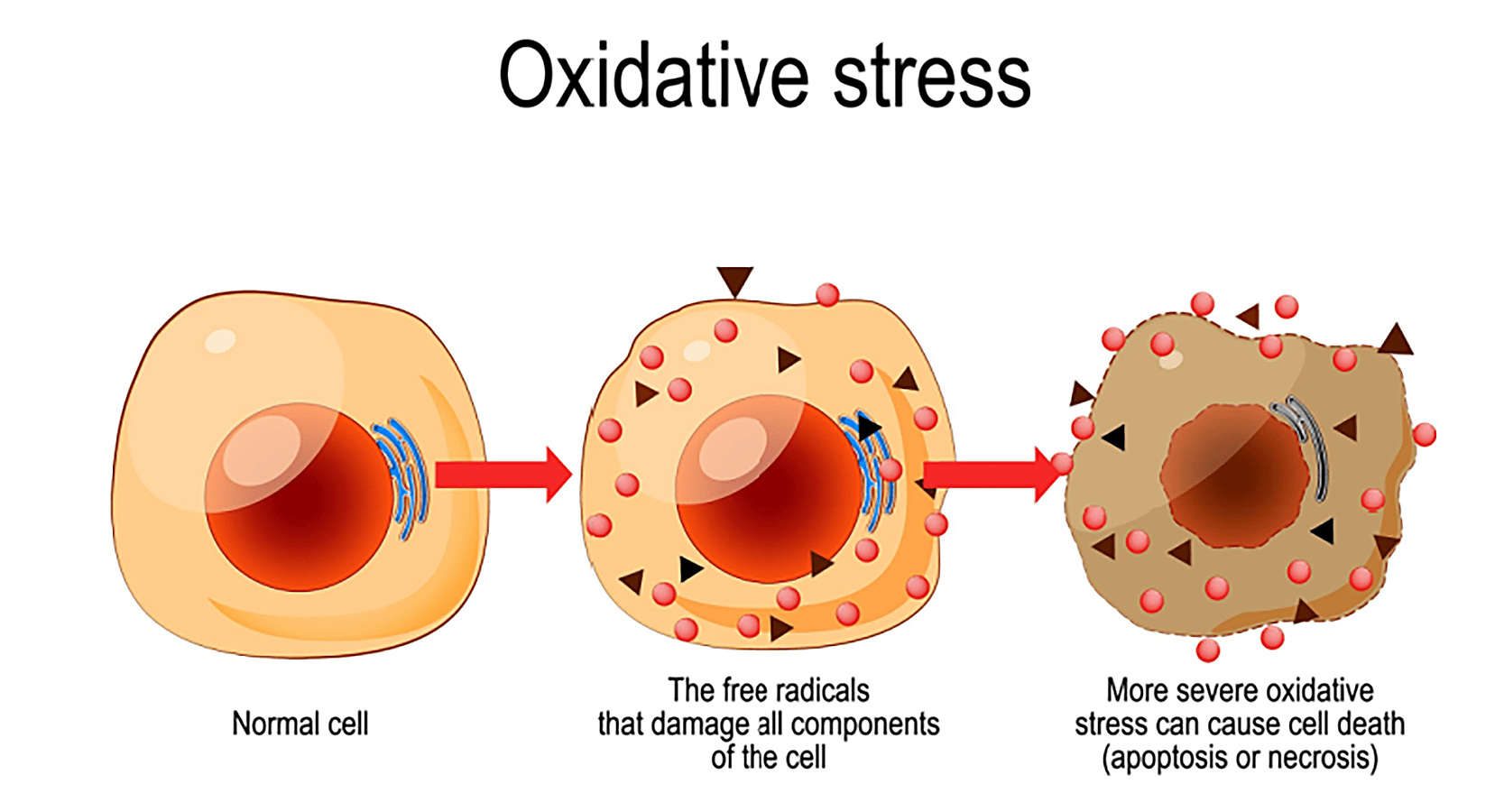 Oxidative stress