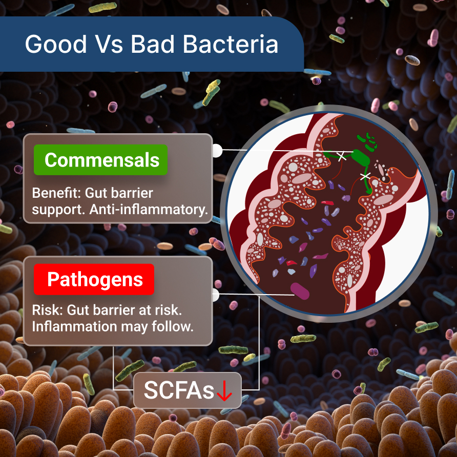 Good vs Bad Gut Bacteria