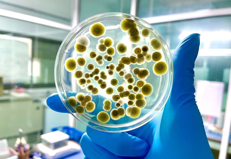 agar plates with various fungal colonies