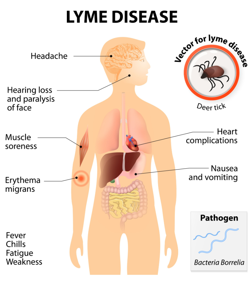 lyme symptoms-1